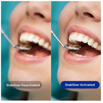 [locale:en] Image stabilization comparison: off vs on — sharper dental recording